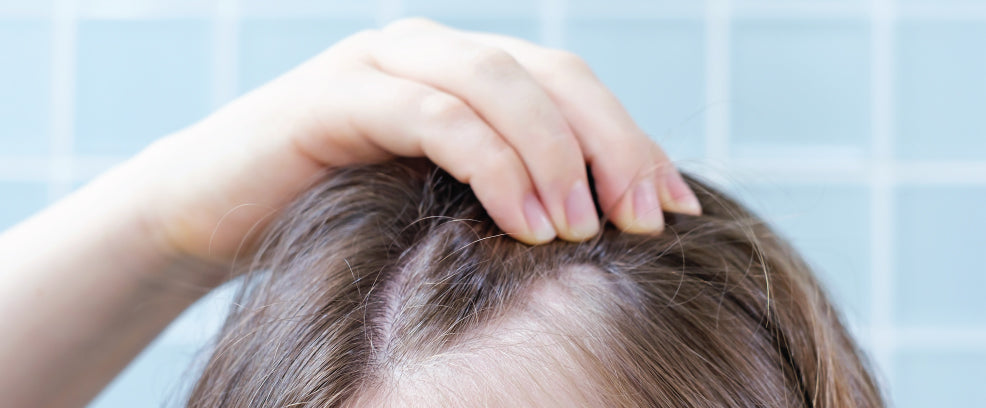 Dry Scalp